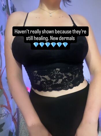 Adept page leaked private photo uncensored HD quality