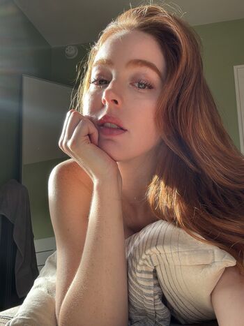 Erna burn leaked private photo uncensored HD quality