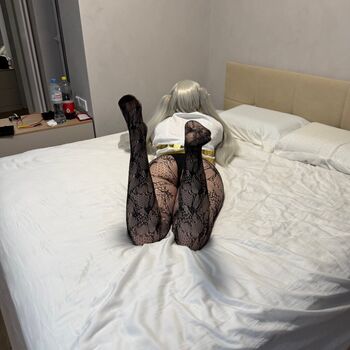 Ykinerd page leaked private photo uncensored HD quality